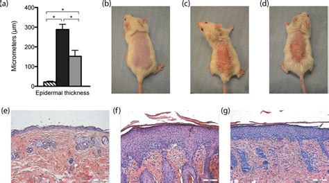 measure skin thickness|epidermal thickness.